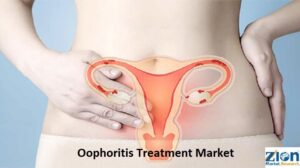 Oophoritis Treatment Market